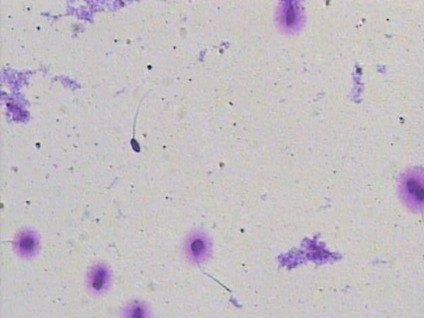 Spermiogram, pregled semenske tekočine